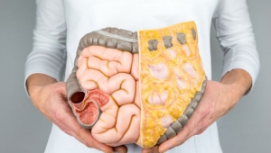 Kalın Bağırsak (Kolon 9 )Kanseri