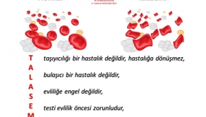 Korkmaz : Talasemi Tedavi maliyeti yüksek ve yıpratıcı iken, hastalıktan korunma ucuz ve kolaydır.